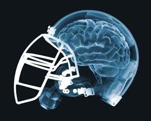TGC-Brain-helmet
