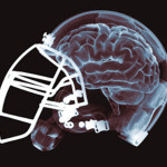 concussions in the NFL
